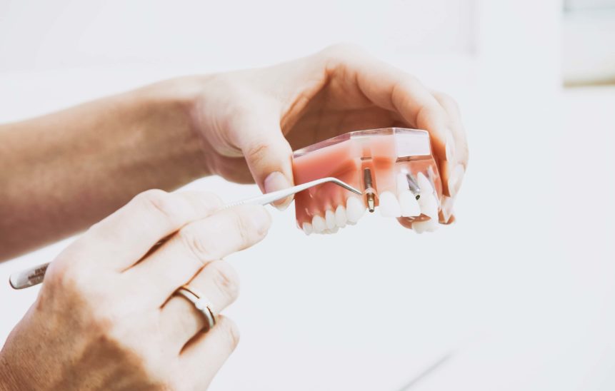 dental treatment truss dental