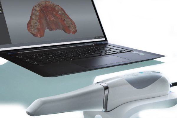 Intra Oral Scanner enable precise 3D scans of your mouth Intra Oral Scanner enable precise 3D scans of your mouth